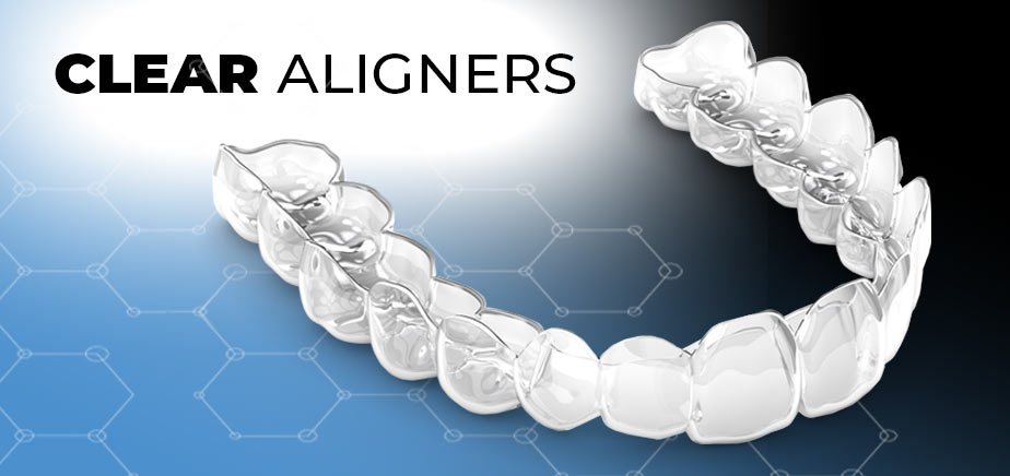 1740726690188263.jpg ALIGNERS.jpg